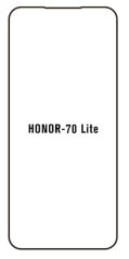 Hydrogel - ochranná fólia - Huawei Honor 70 lite Hydrogel - ochranná fólia - Huawei Honor 70 lite