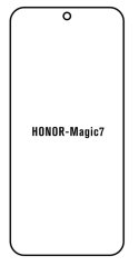 engaroGuard Hydrogel - ochranná fólia - Huawei Honor Magic 7